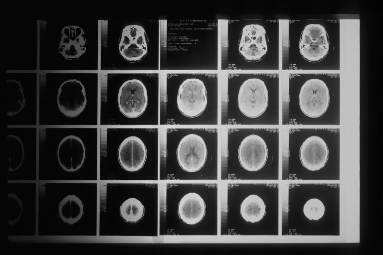 Diagnóstico de cáncer sin bisturí gracias a una IA