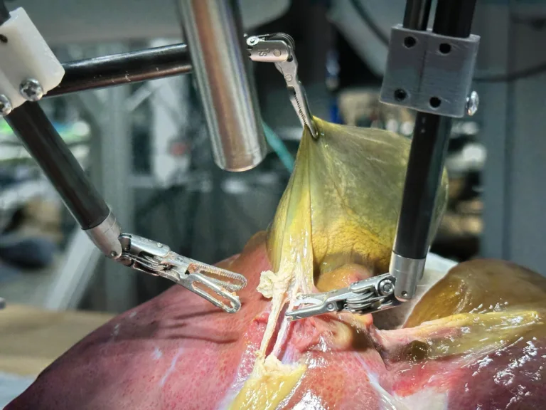 Robot realiza una cirugía compleja de forma autónoma
