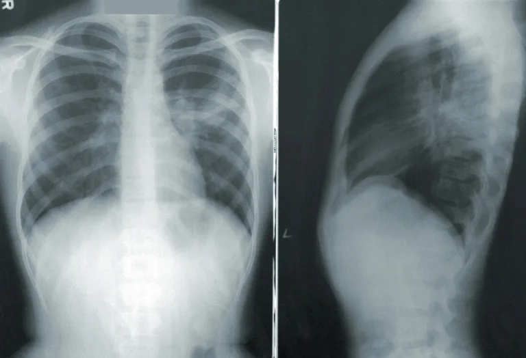 Un respiro para los pacientes gracias a la IA