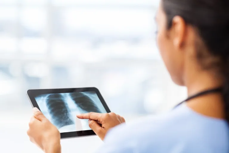 Radiología explicable: Microsoft impulsa una IA que justifica cada diagnóstico